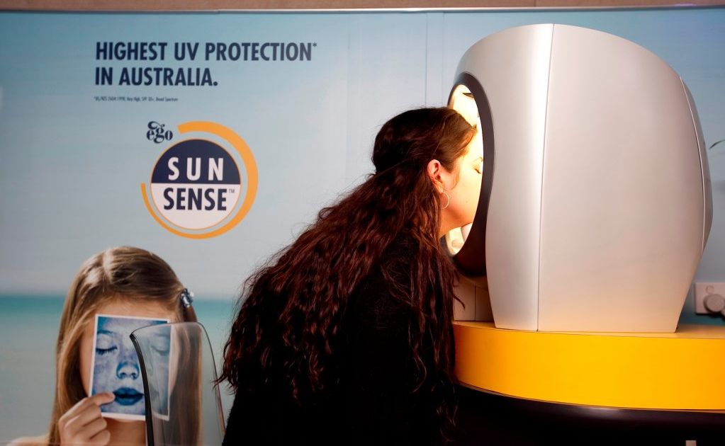 Corrine Williamson has her skin UV analysed. Corrine Williamson has her skin UV analysed.